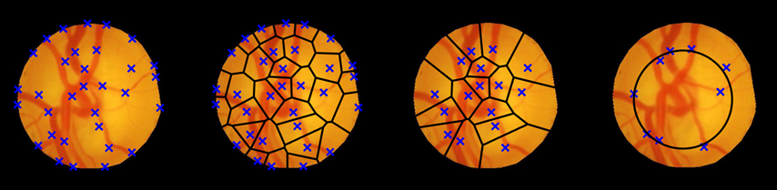 Featured image from A Structure Tensor based Voronoi Decomposition Technique for Optic Cup Segmentation.